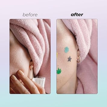 Vitamasques Acne Patch Face Mask Set, 4-Pack - Hydrocolloid Patches 80 Count (Salicylic & Tea Tree, Salicylic & Niacinamide) - Korean Skin Care - Reduce Oil Build-Up for Blackheads