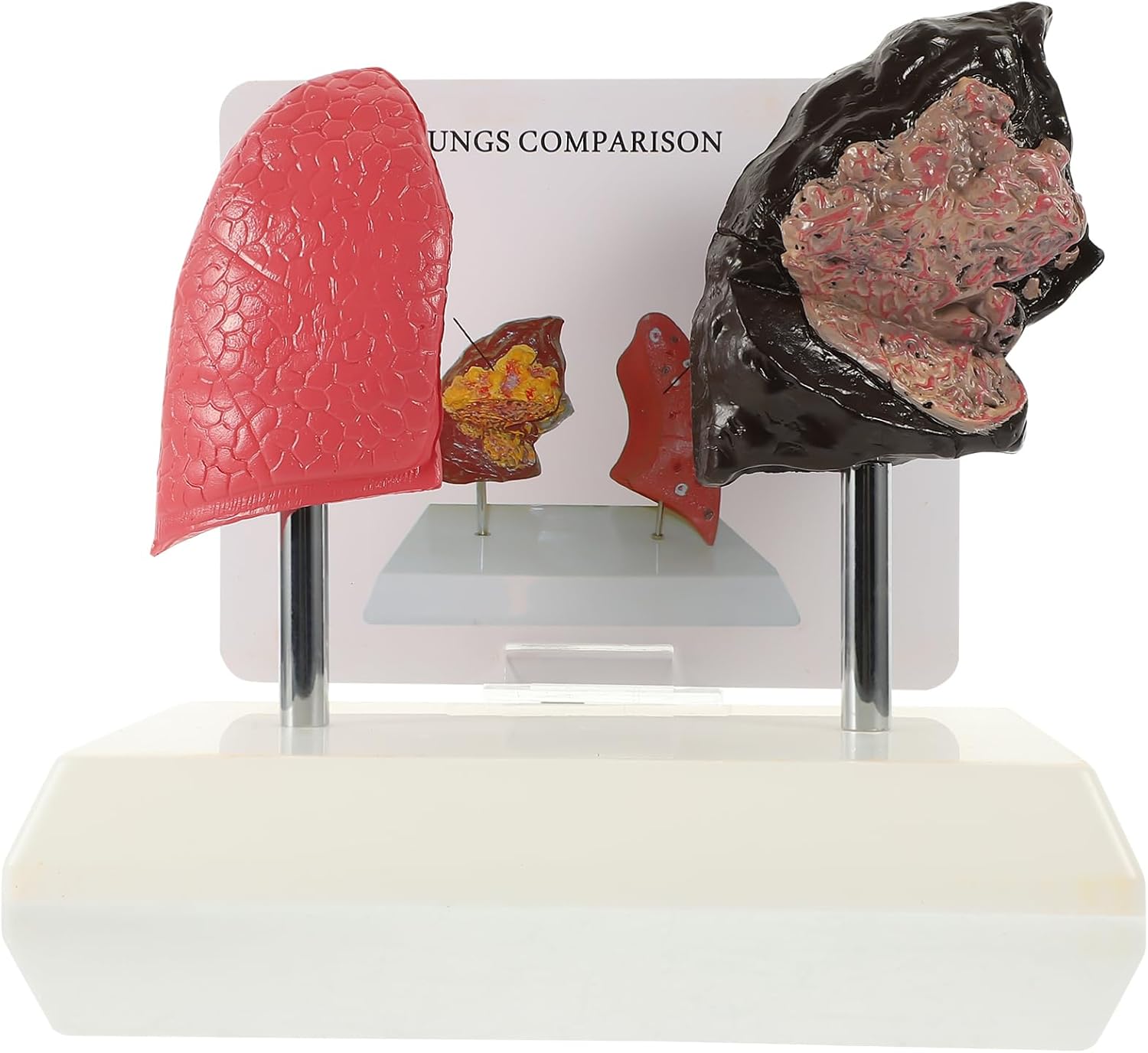 Pulmonary Anatomy Model Smoking Healthy Lung Teaching Tool Pvc Material