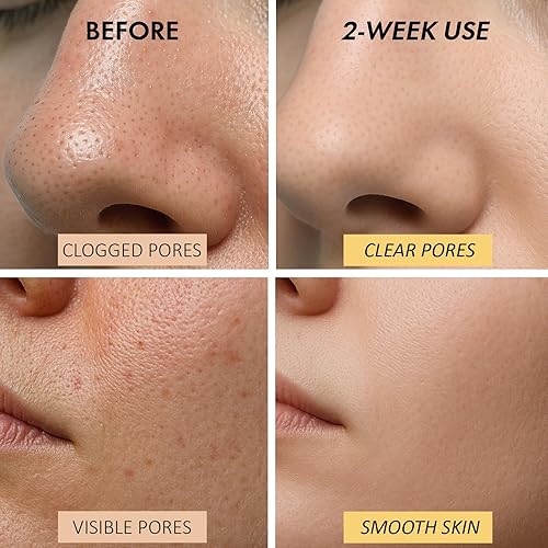 Miniatura 6 de Máscara facial de arcilla calentadora para limpieza profunda de poros  Máscara de barro autocalentable para cara, removedor de puntos negros y