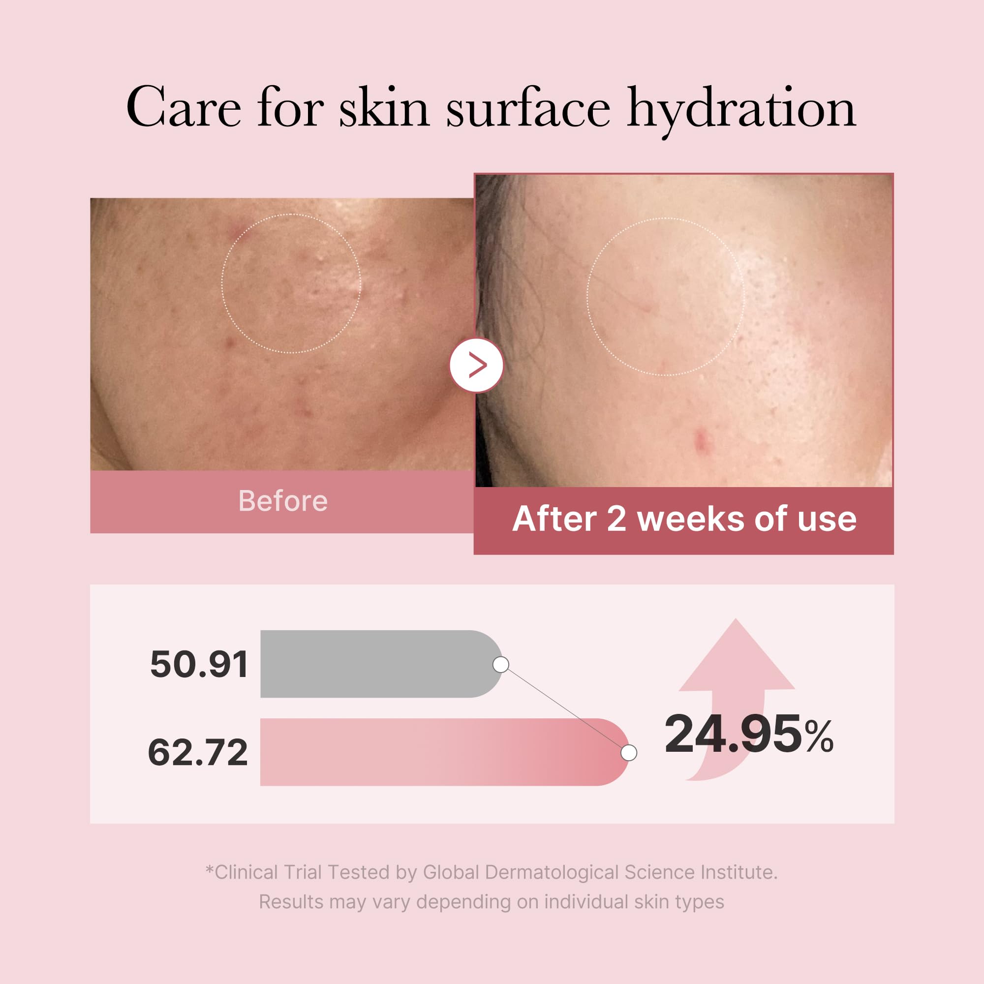 Amazon.com: medicube Salmon DNA PDRN Pink Glutathione Spray Serum I Pink  Glass Glow Serum Mist for Moisturizer, Soothing and Firming, Uneven skin  tone, Salmon PDRN & Niacinamide, Korean skin care (3.38 fl