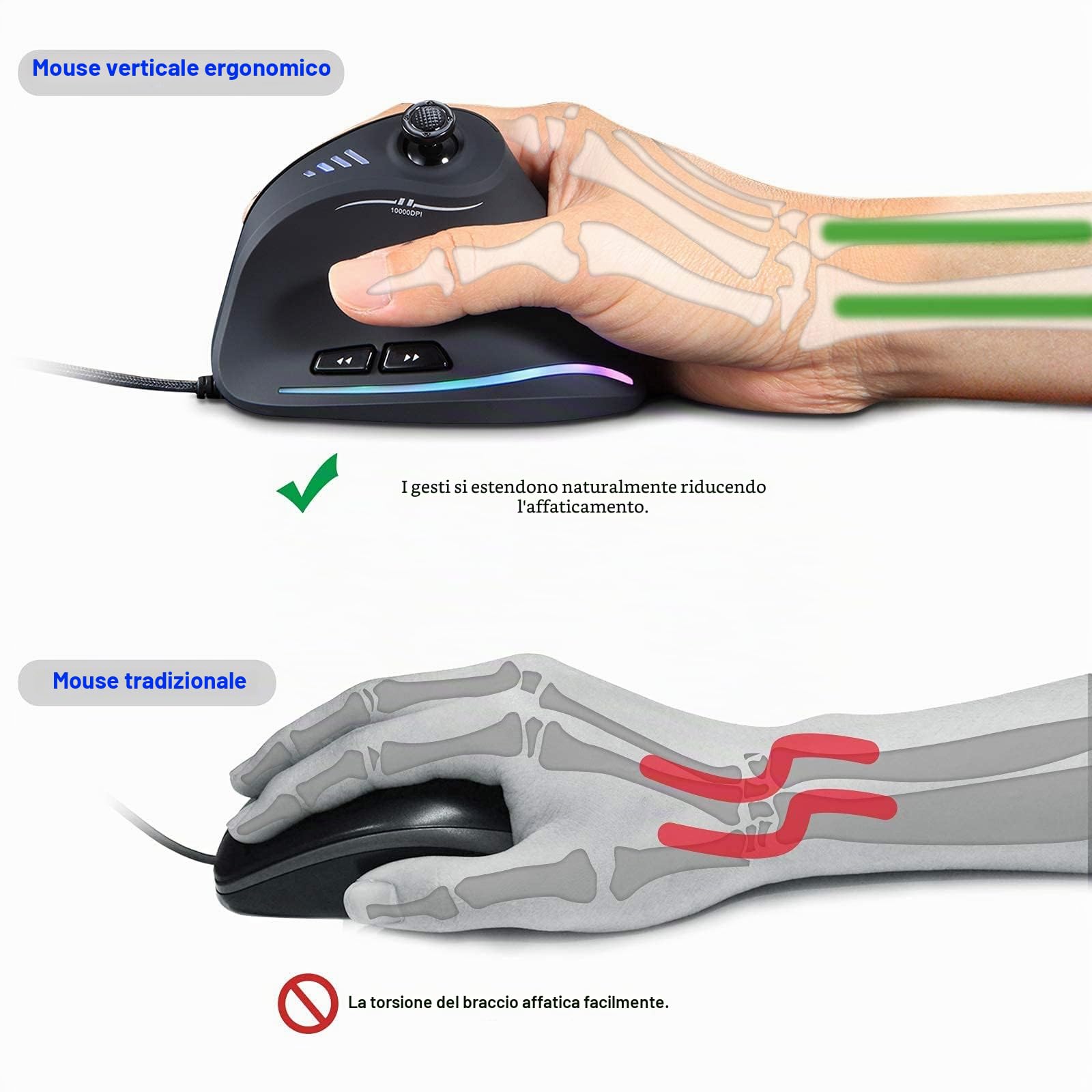 TKMARS Mouse Verticale Gaming, con Rocker 11 Pulsanti Programmabili, 10000 DPI Regolabile, per PC/Mac e Laptop, Mouse Ergonomico Verticale per Diminuire Il Male al Polso