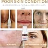 Aobenz Whitening and Freckle Removing Essence (3Pcs)