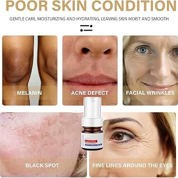 Aobenz Serum, Aobenz Whitening and Freckle Removing Essence, Aobenz Anti-Spot Serum, Aobenz Spot Remover Serum, Aobenz Dark Spot Correcting Serum, Brightening and Removing Freckles (2Pcs)