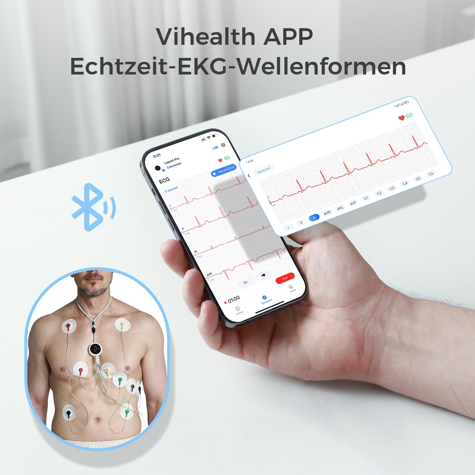CheckMe LepodPro ECG portable à 12 dérivations avec écran OLED, enregistrement ECG en temps réel pendant 24 heures, marqueurs d'événements, rapport ECG détaillé par IA, rechargeable, support pour