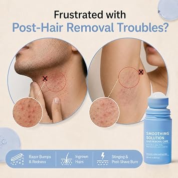 Razor Bump Smoothing Solution Ingrown Hair Reduction with BHA AHA, 50ml*2 | High Roller Ingrown Tonic for Underarms Abdomen - Ingrown Hair Serum for Men & Women - Roller Ball Applicator for Tend Skin