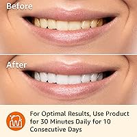 Vista 5 de Yaxa Basics Kit de tiras blanqueadoras de dientes de 10 días, 10 tratamientos, 1 paquete (anteriormente Solimo)