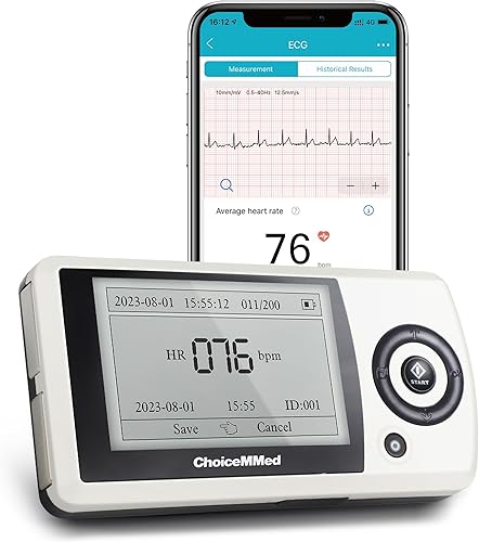ChoiceMMed Monitor de ECG portátil - Graba ECG y frecuencia cardíaca en movimiento - Soporte para almacenar hasta 200 registros - No requiere
