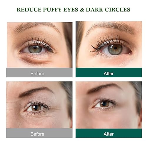 Miniatura 4 de 60 máscaras de aloe vera para debajo de los ojos, reducen los ojos hinchados y las ojeras, se ven jóvenes con una piel firme y mejorada debajo de