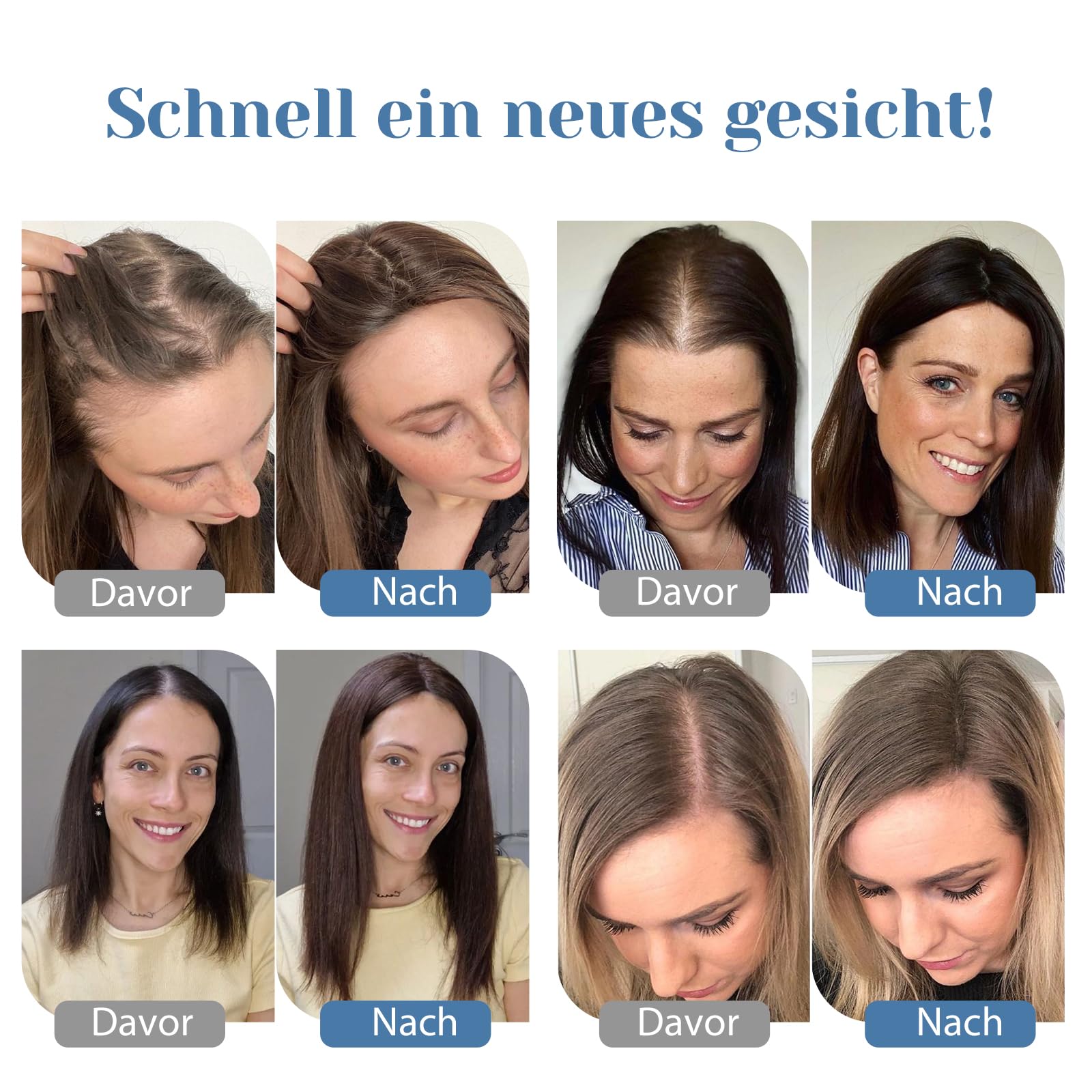 Haar Toppers für Frauen Echthaar Topper Leichtes Toupets für Frauen, 100% handgeknüpfte Toupets Clip in Haarteil für Dünner Haar Oberkopf Flauschiger Glatter Hair Topper ohne Pony(4T10/16#)