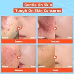 dewyhour Hypochlorous Acid Spray for Face: Gentle Facial Mist to Soothe Sensitive Skin, Reduce Irritation, Clear Pores, Facial Toner for Pre and Post Workout with First Aid Relief, Korean Skincare