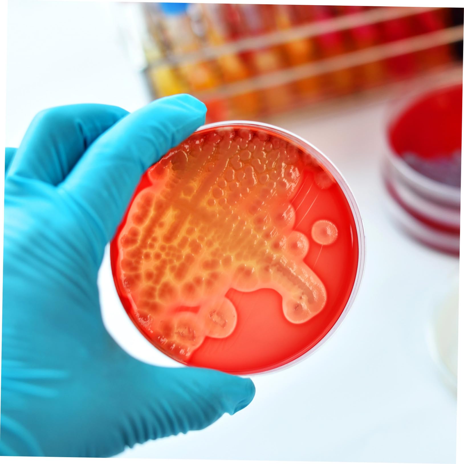 Plaques D’agar Pré-coulées de Laboratoire 7cm, 20 Pièces