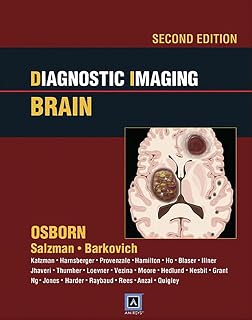 Diagnostic Imaging: Brain