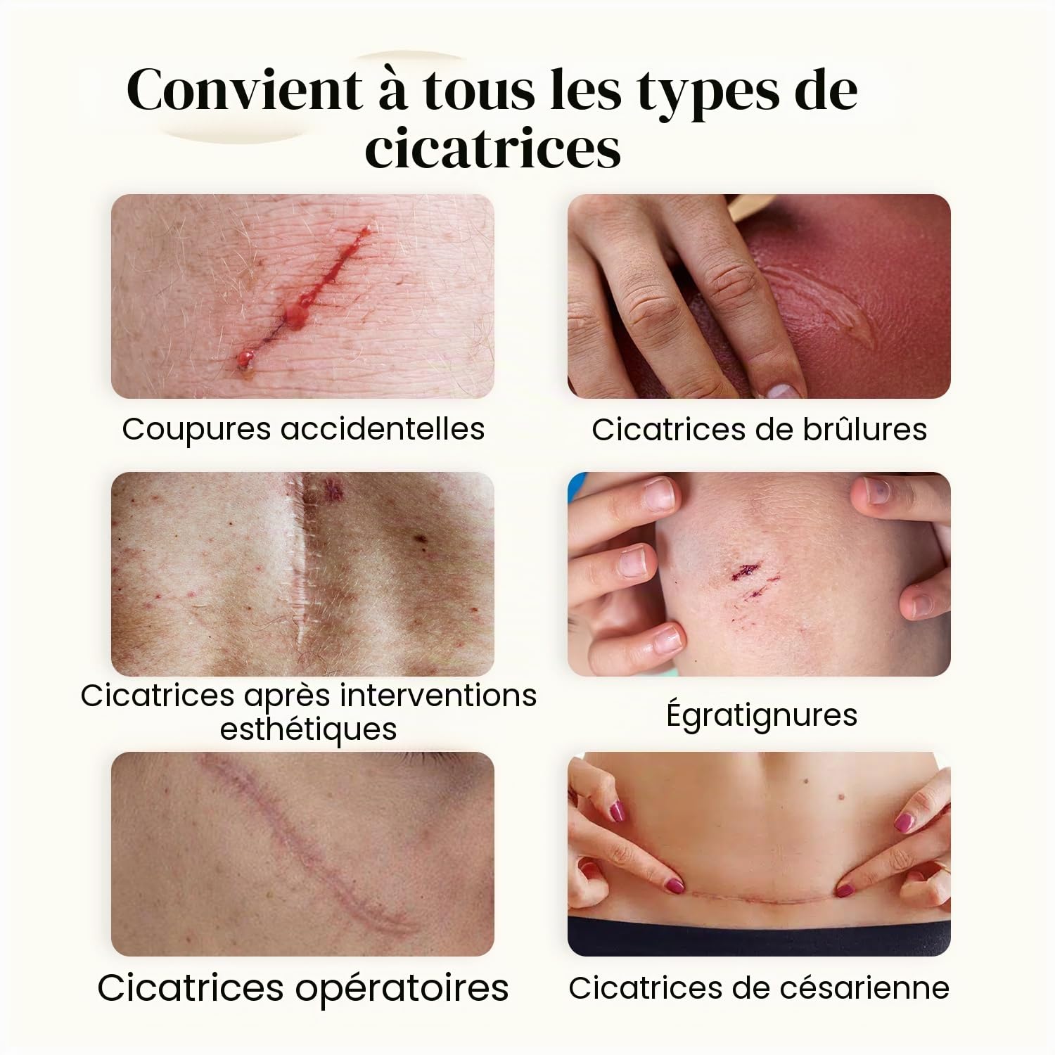 Dermatix Ultra Gel anti-cicatrices postopératoire soin des cicatrices 15 g