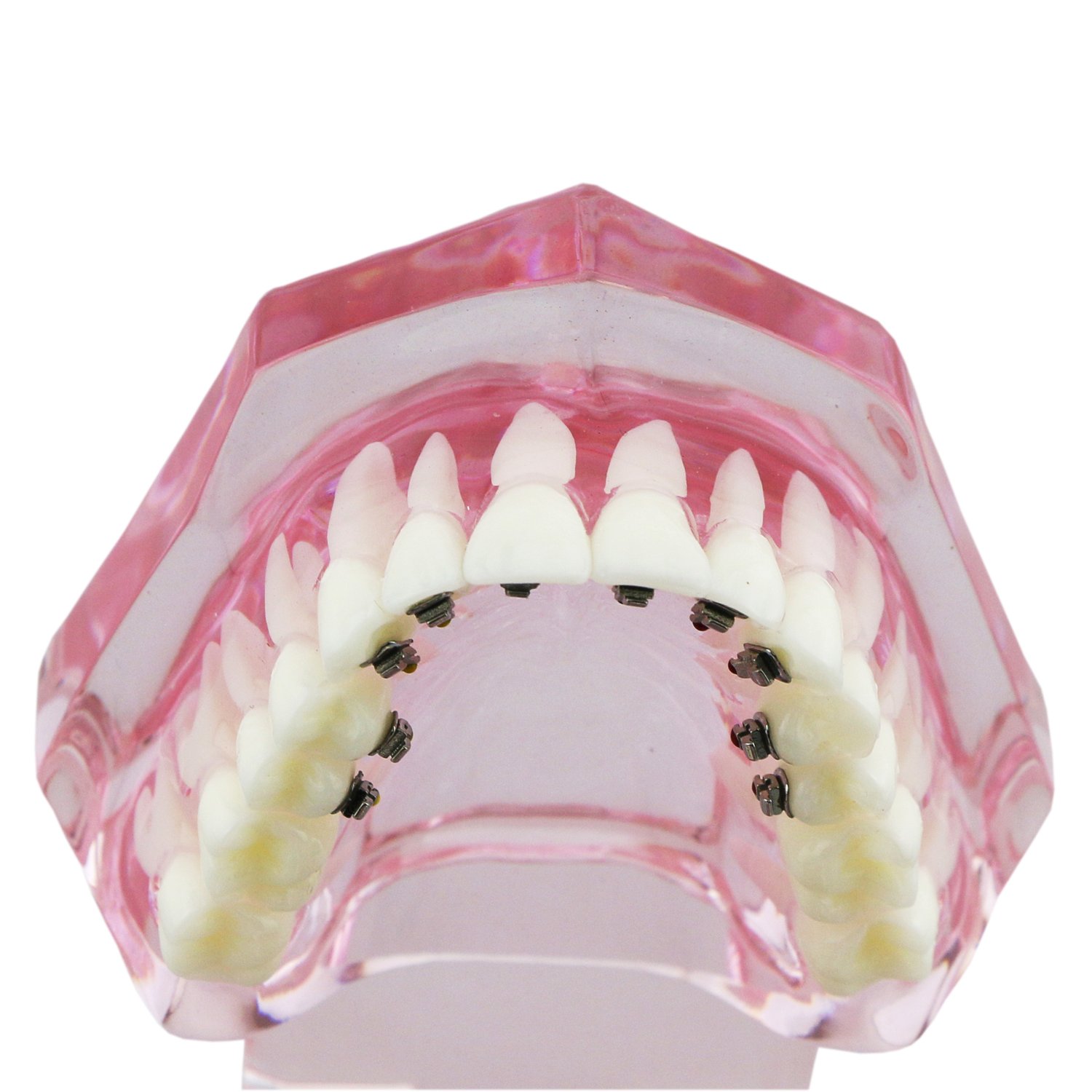 Amazon.co.jp: 歯科模型3004 歯の模型 舌側矯正展示模型