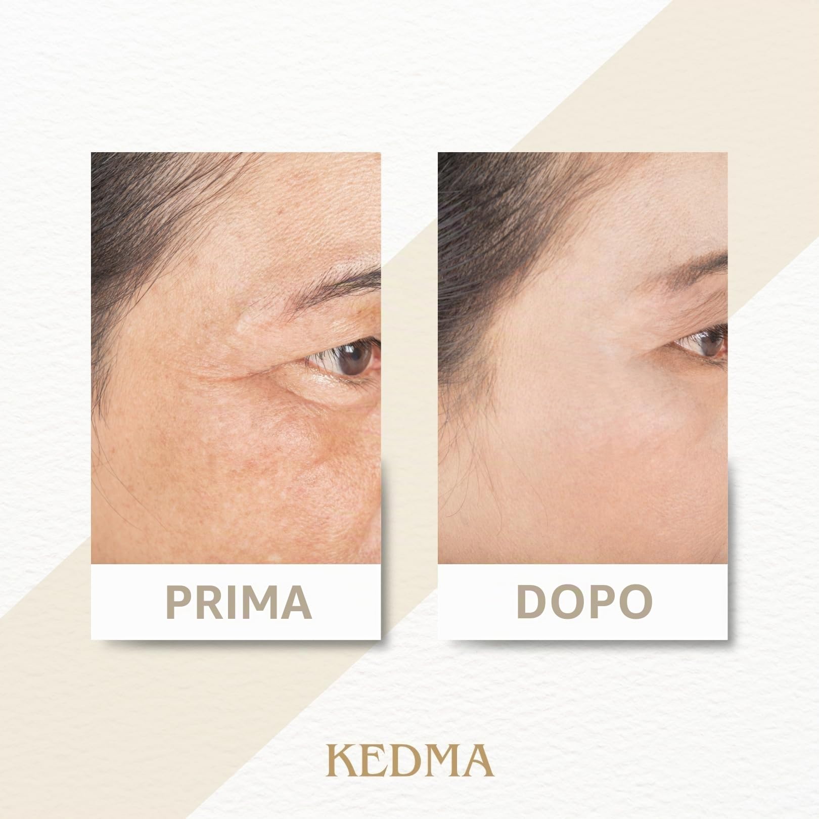 KEDMA - Siero Giorno Elixir con Acido Ialuronico e Vitamine A & E - 30g | Il siero Elixir Giorno con acido ialuronico e vitamine A & E idrata e leviga senza lasciare residui grassi.