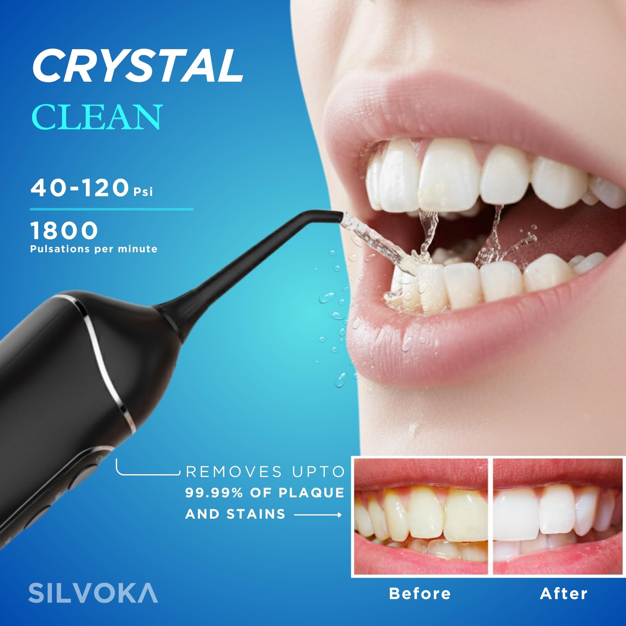 Irrigador bucal para dientes, irrigador bucal inalámbrico, irrigador dental portátil con tanque de 300 ml, 4 modos de limpieza, IPX7 impermeable, púa de hilo dental recargable para aparatos
