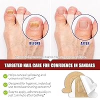 Vista 2 de Parches de uñas fúngicas para uñas de los pies, (32 piezas) tratamiento de hongos en las uñas de los pies, extra fuerte para cuidado de uñas durante