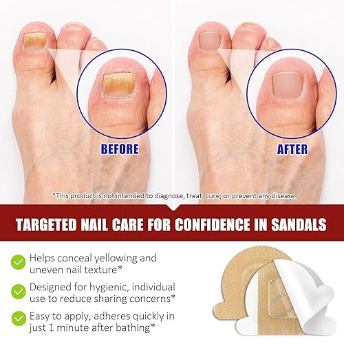 Vista 2 de Parches de uñas fúngicas para uñas de los pies, (32 piezas) tratamiento de hongos en las uñas de los pies, extra fuerte para cuidado de uñas durante