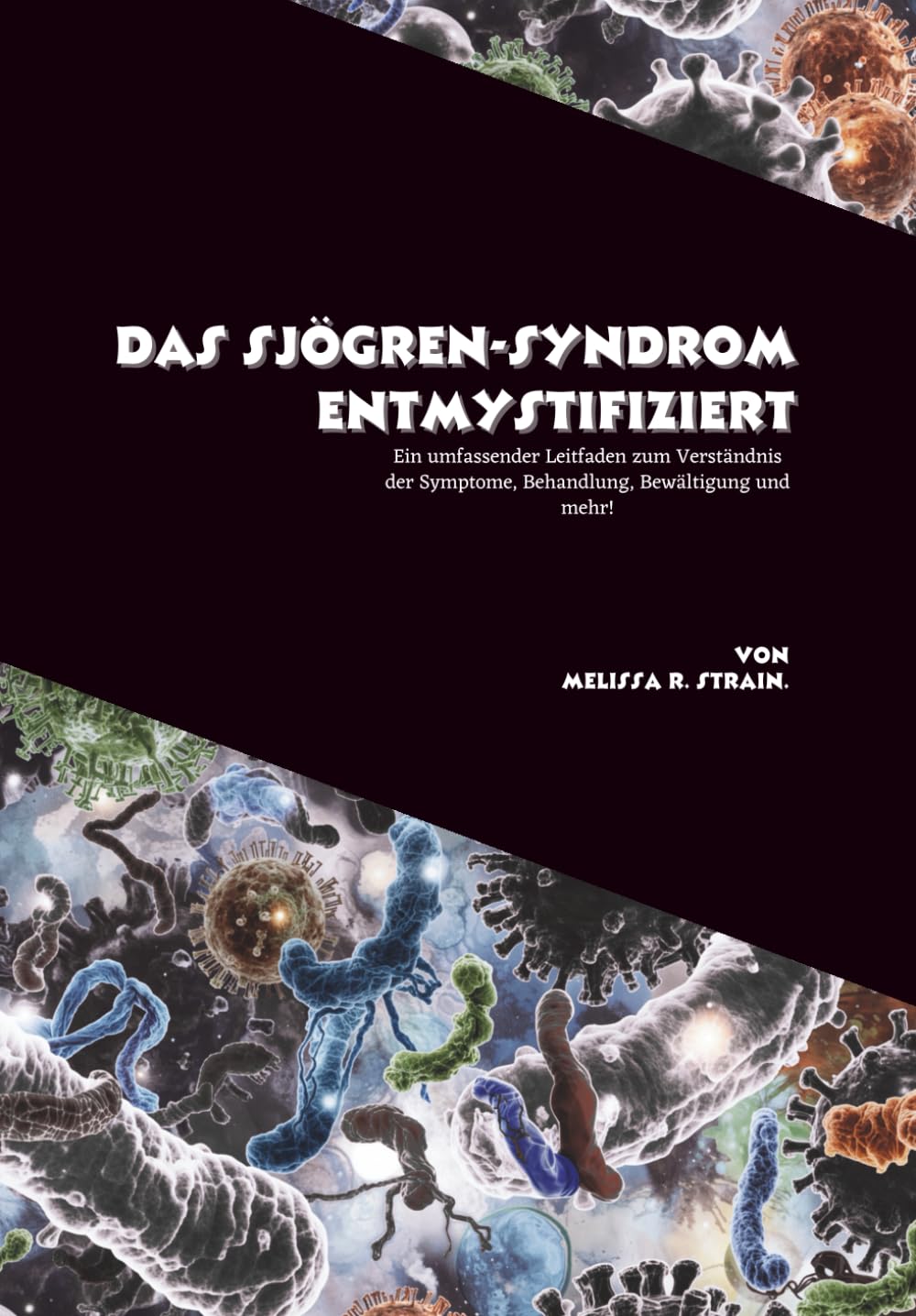 Das Sjögren-Syndrom entmystifiziert: Ein umfassender Leitfaden zum Verständnis der Symptome, Behandlung, Bewältigung und mehr!