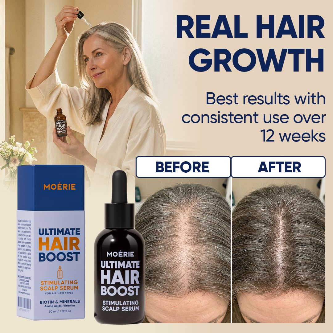 MOERIE serum anticaída y serum crecimiento cabello - Tratamiento anticaída para el cabello delgado - Alternativa al hair oil y el aceite capilar para crecimiento cabello - efectivo y natural 50ml x3