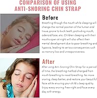 Vista 2 de Correa de barbilla antironquidos, correa de barbilla de tamaño pequeño para ronquidos, reduce los ronquidos, dispositivo transpirable antironquidos