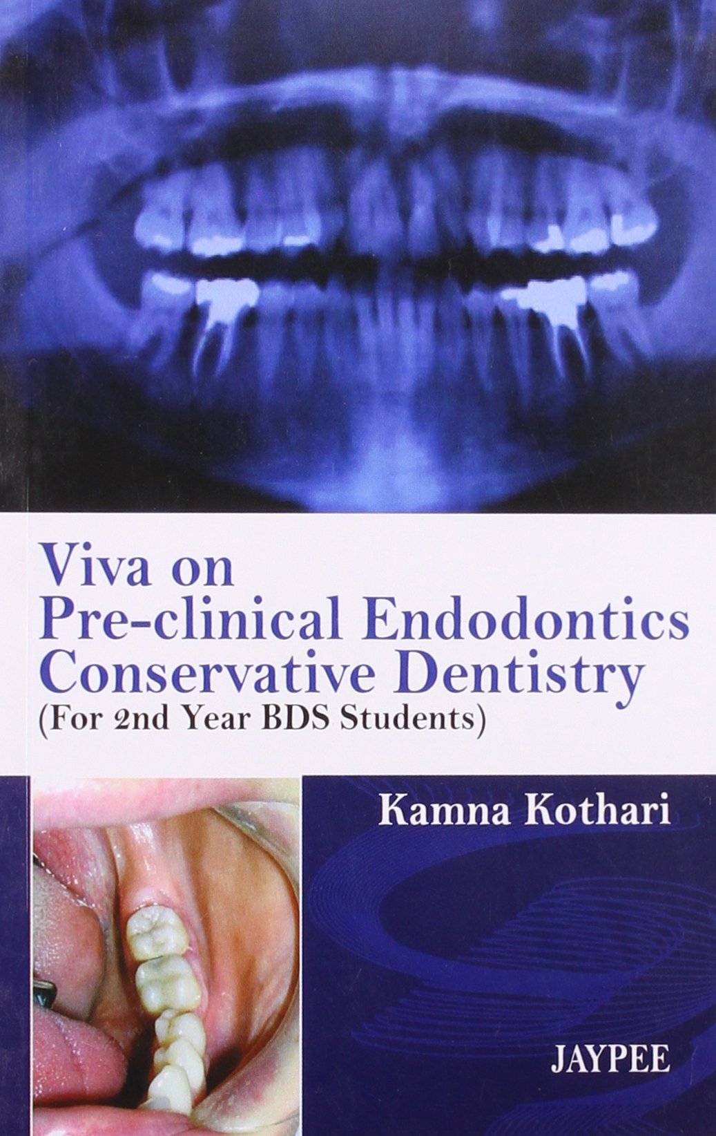 Buy Viva on Pre-clinical Endodontics Conservative Dentistry for 2nd ...