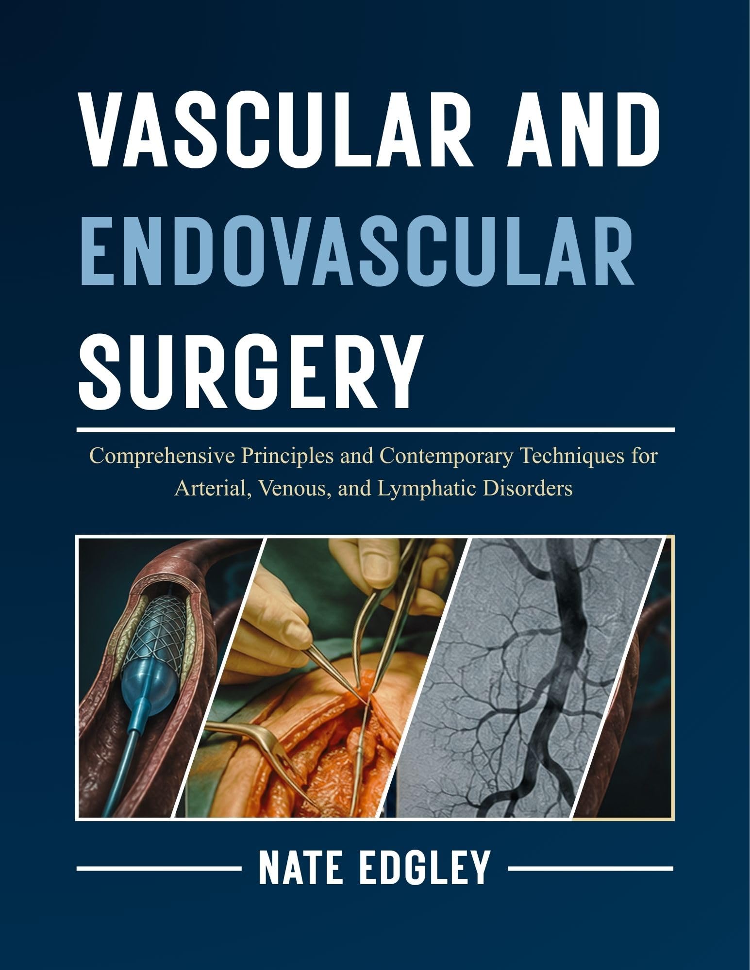 VASCULAR AND ENDOVASCULAR SURGERY: Comprehensive Principles and Contemporary Techniques for Arterial, Venous, and Lymphatic Disorders (English Edition)