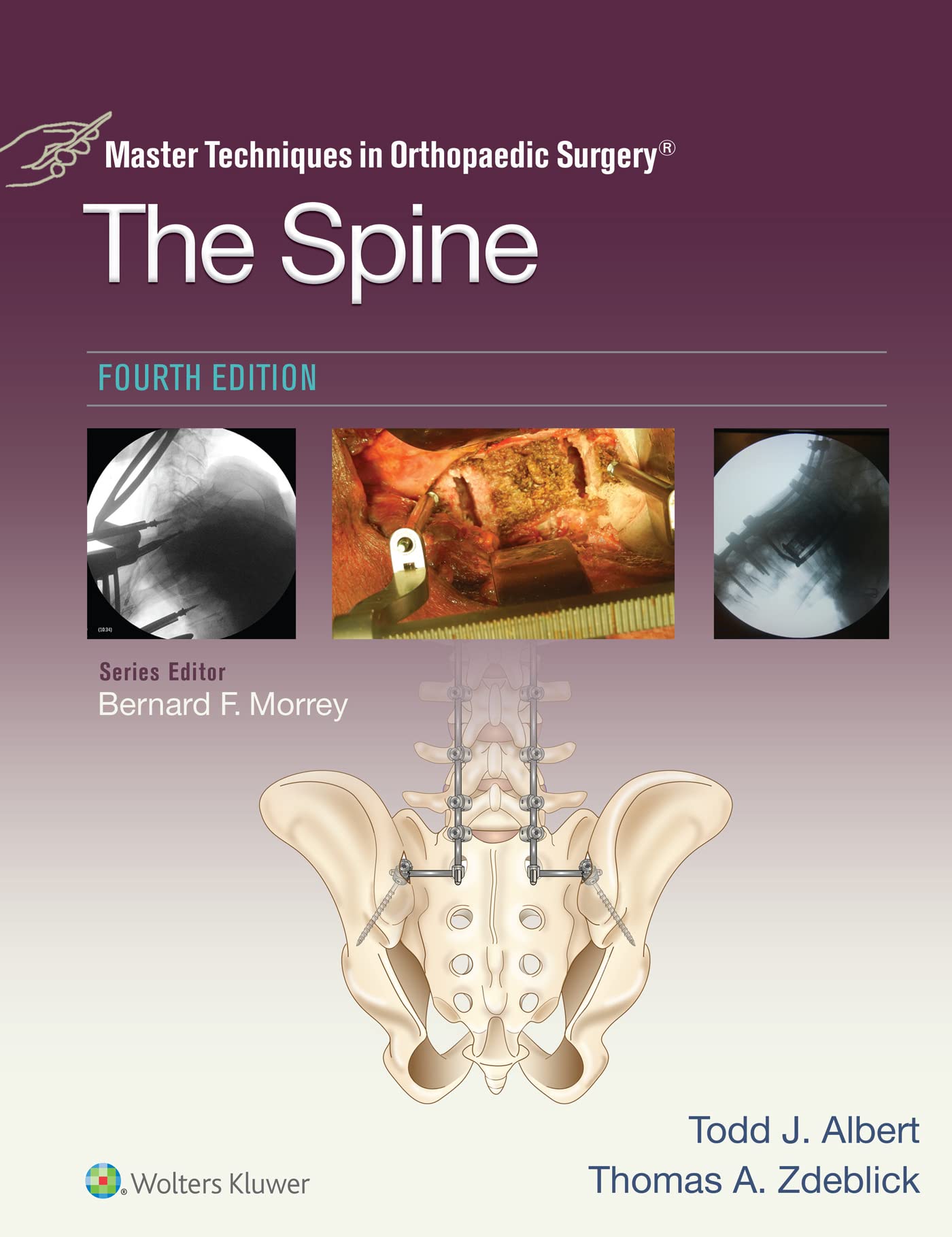 Master Techniques in Orthopaedic Surgery: The Spine (English Edition)