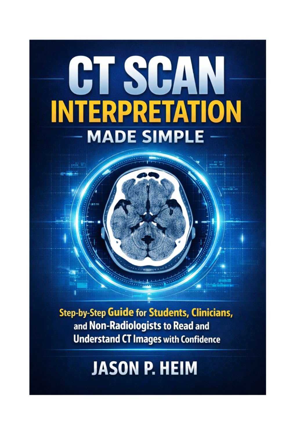 CT SCAN INTERPRETATION MADE SIMPLE: Step-by-Step Guide for Students, Clinicians, and Non-Radiologists to Read and Understand CT Images with Confidence