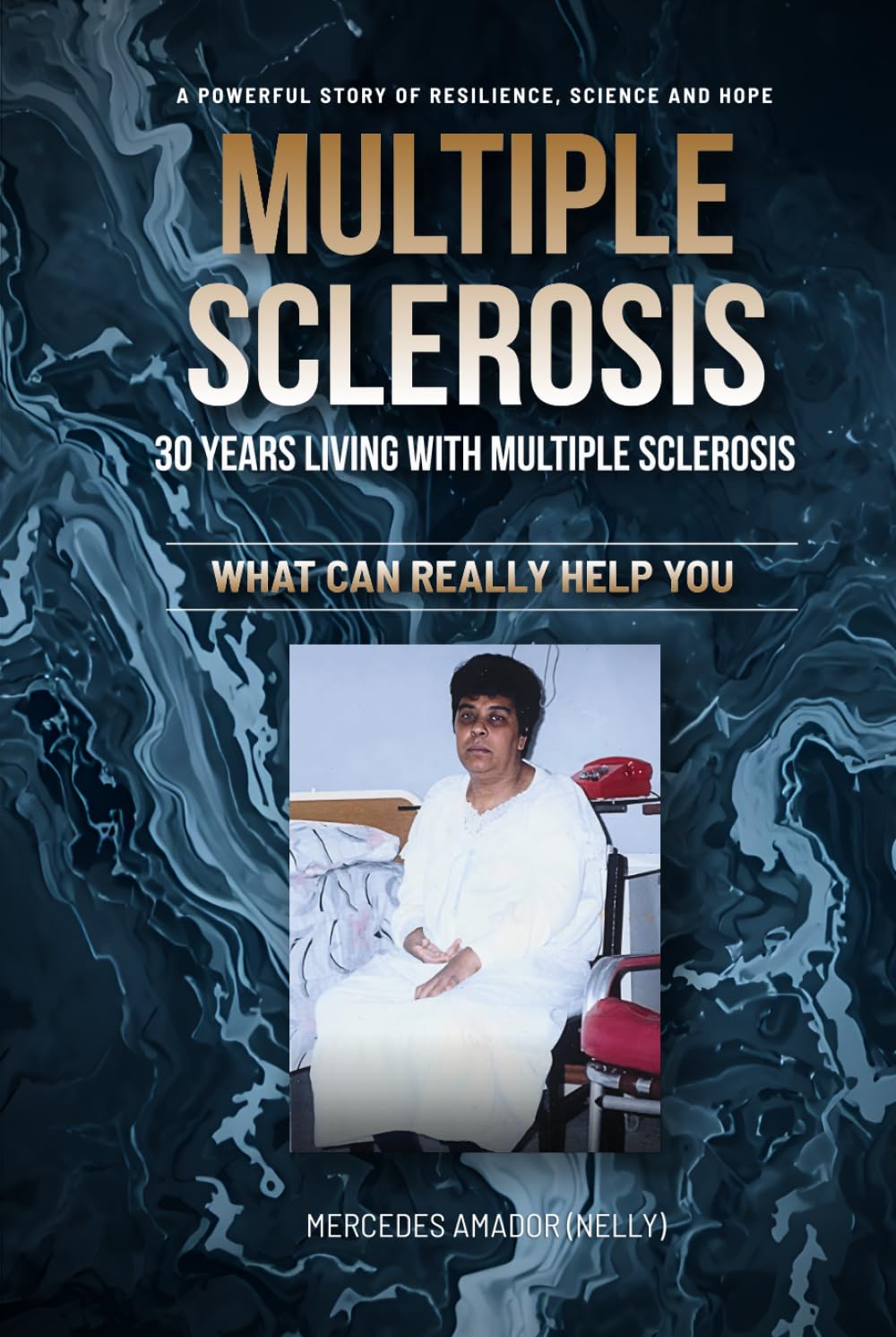 MULTIPLE SCLEROSIS 30 YEARS LIVING WITH IT: WHAT CAN REALLY HELP YOU