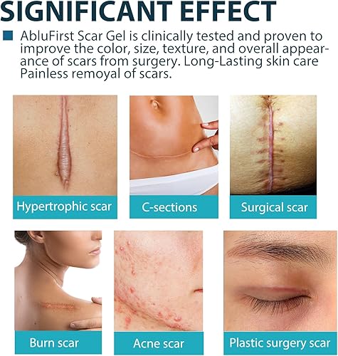 Miniatura 9 de Cinta de silicona para cicatrices (rollo de 1.6 x 60 pulgadas, rollo de 4.9 ft), hojas de cicatriz de silicona médica, tiras, cicatrices, hojas