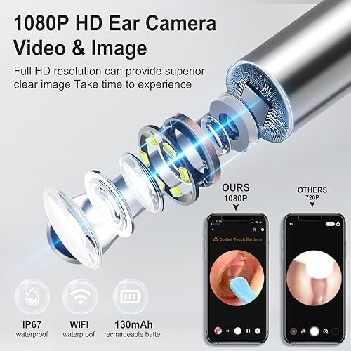 Miniatura 2 de Eliminación de cera de oídos, limpiador de oídos con cámara con 1080P, herramienta de eliminación de cera de oídos con 6 luces LED, kit de