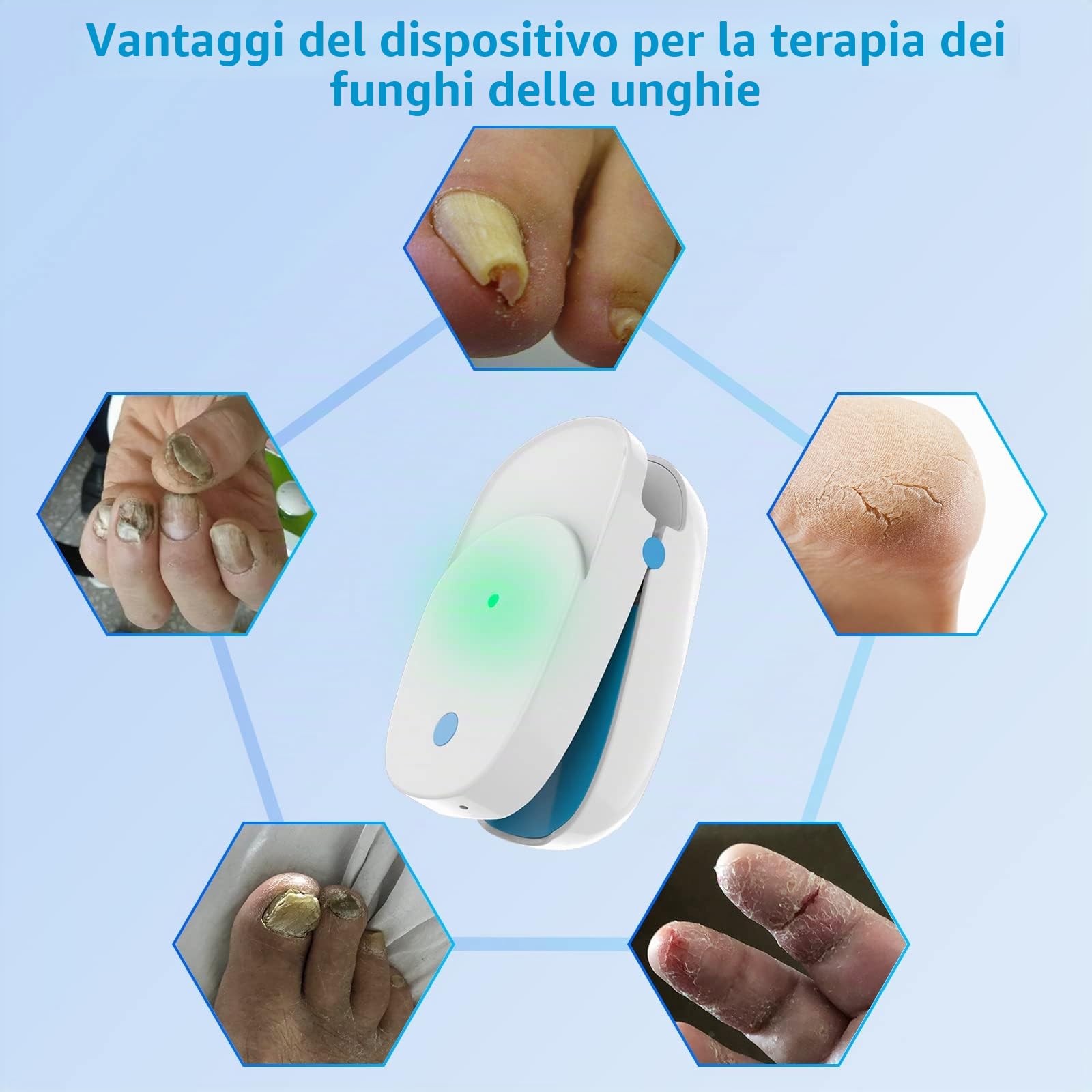iKeener Smalto Trattamento Funghi Delle Unghie,Dispositivo Portatile Terapia Laser Freddo Pulizia Delle Unghie,Forniture Ricaricabili Cura Dita,Dei Piedi,Domestico,Indolore,Cura Dell'onicomicosi