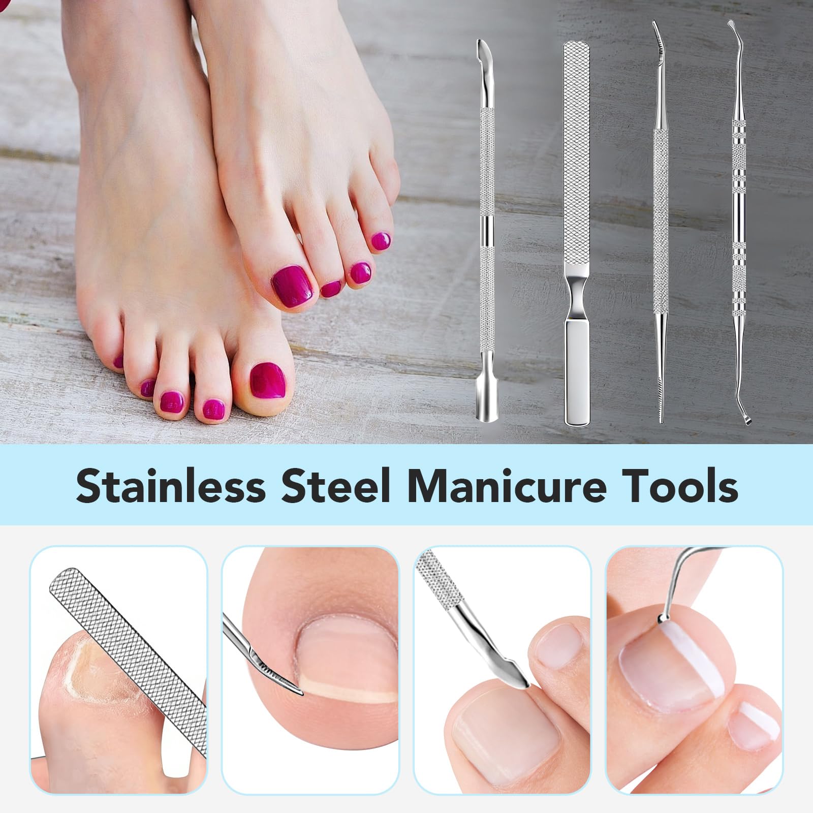 Juego de corrección de uñas encarnadas, juego de herramientas simple para uñas encarnadas, pinza para uñas de los pies con parche corrector de uñas, juego de cuidado profesional de los pies de