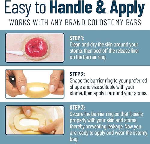 Miniatura 4 de Anillos de barrera para ostomía elegibles para FSA y HSA, 10 anillos de estoma de 0.157 pulgadas de grosor, suministros de colostomía para