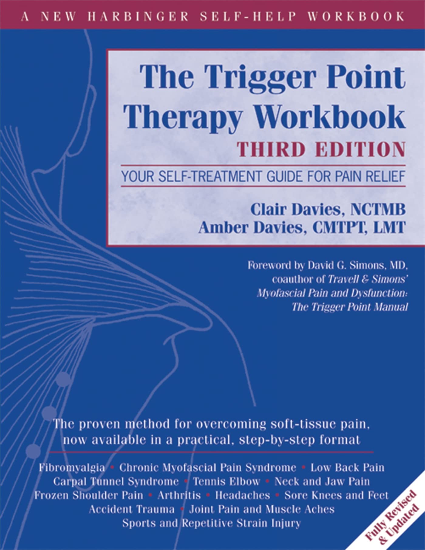 The Trigger Point Therapy: Your Self-Treatment Guide for Pain Relief (A New Harbinger Self-Help Workbook) Paperback – Illustrated, September 1, 2013