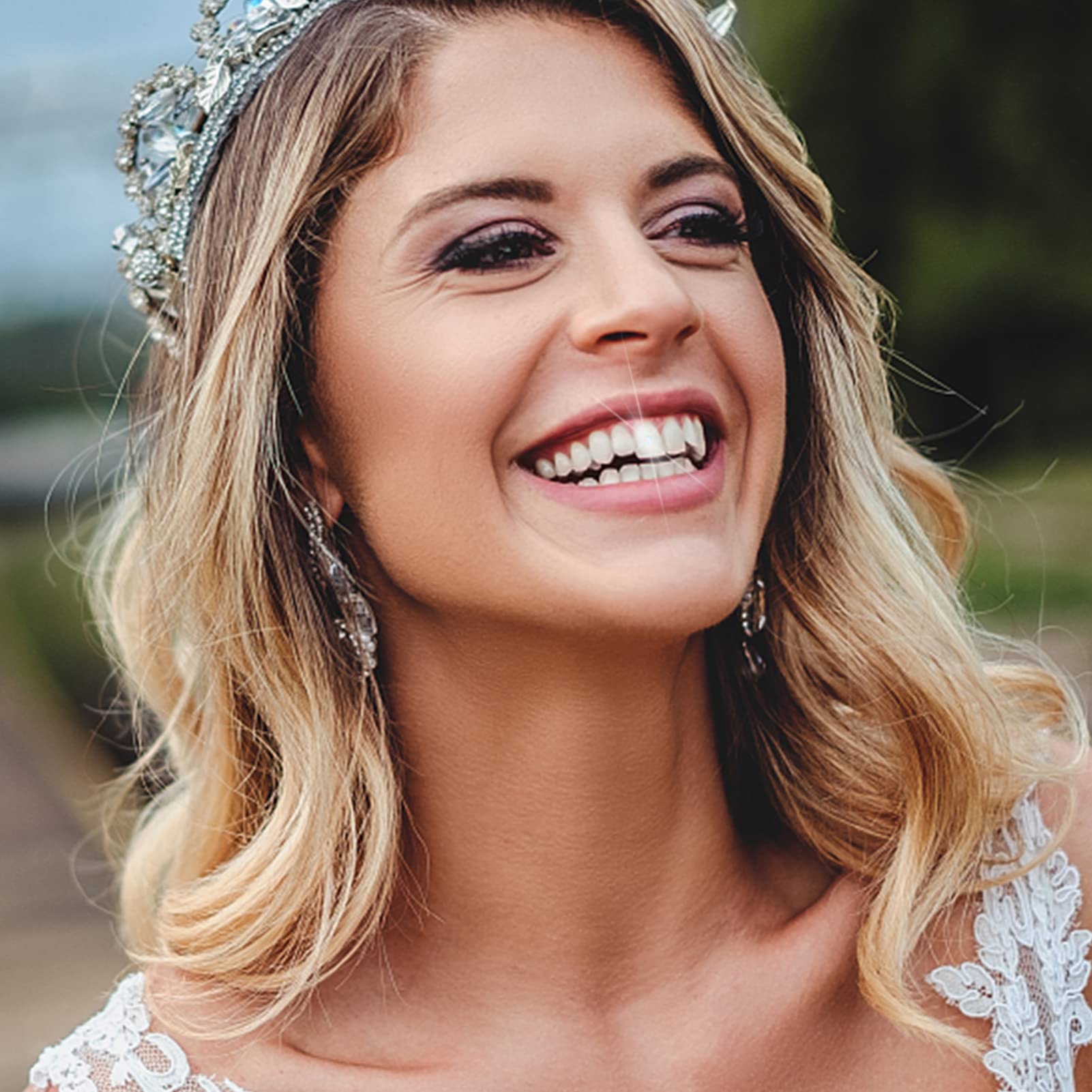 minkissy Decor Accessories 20pcs Teeth Ornaments Crystal Shiny Reflections Unique for Teeth Decorati