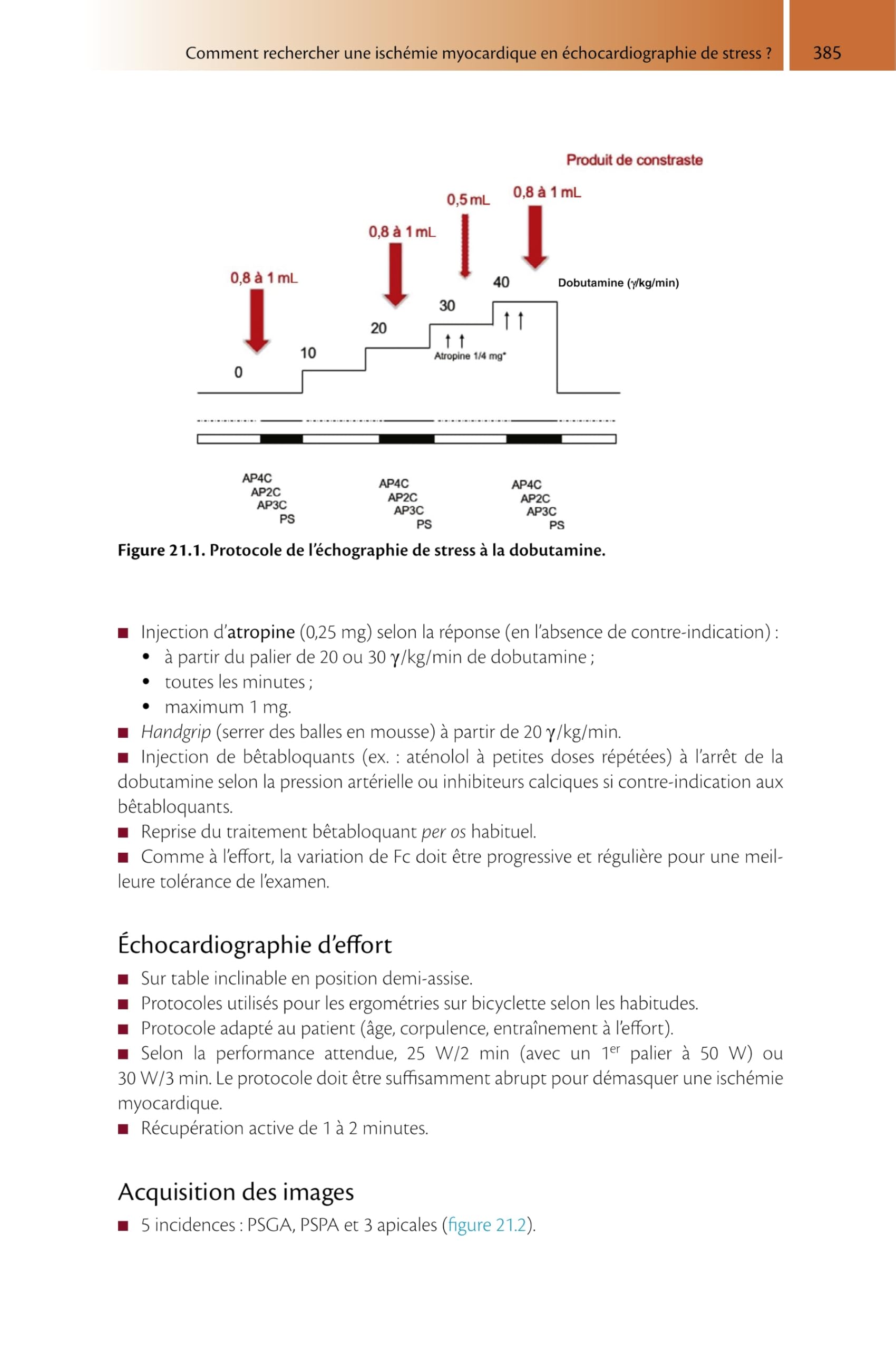 Guide pratique d'échocardiographie