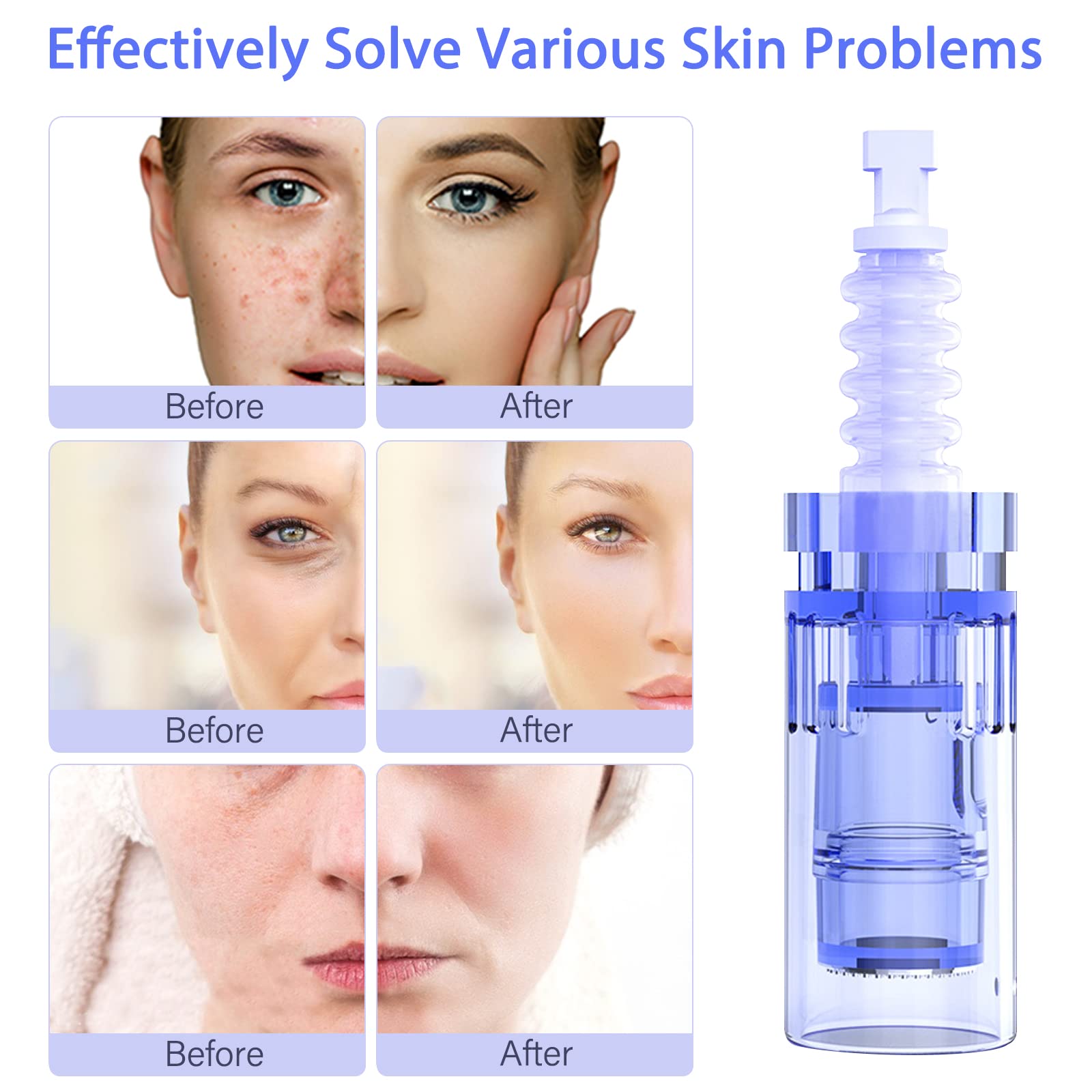 20 Pcs Agujas Dermapen Microneedling 36 Pin Microagulhas Agulhas De Repuesto Micro Aguja Cartucho De Slot Baioneta Regular Microneedle Cartuchos Dermapen Para Microneedling Derma Substituição Pen