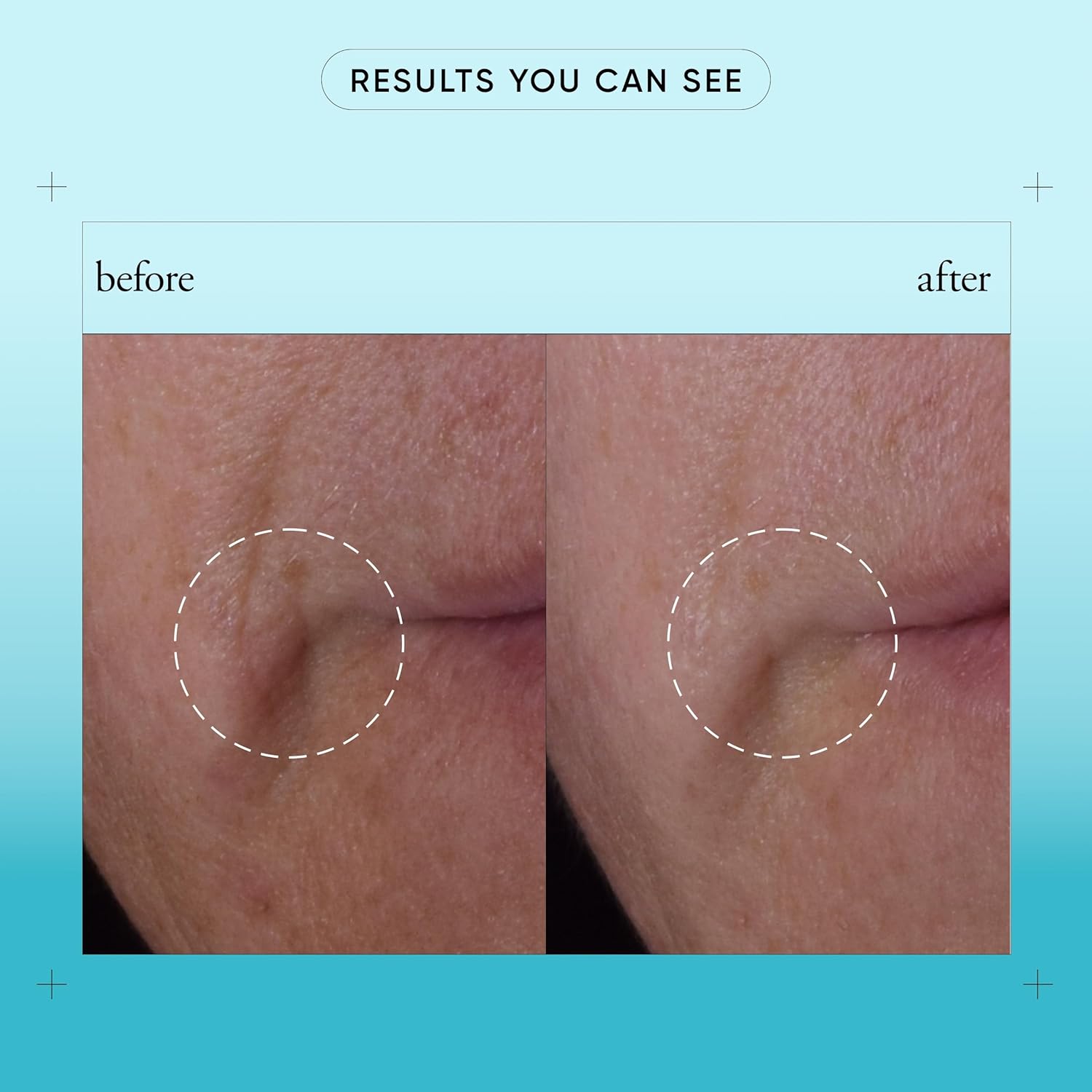 philosophy dose of wisdom bouncy skin reactivating facial serum - with hyaluronic acid, vitamin C & a patented vitality booster - delivers skin that is bouncy, plumped & radiant in one week - Image 4