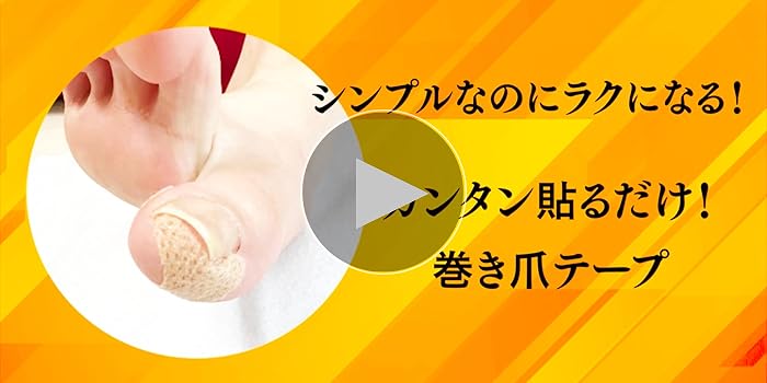 さわこさん専用　　　ペディグラスニュースタンダードスタイル　巻き爪 2025年最新】ペディグラスの人気アイテム - メルカリ
