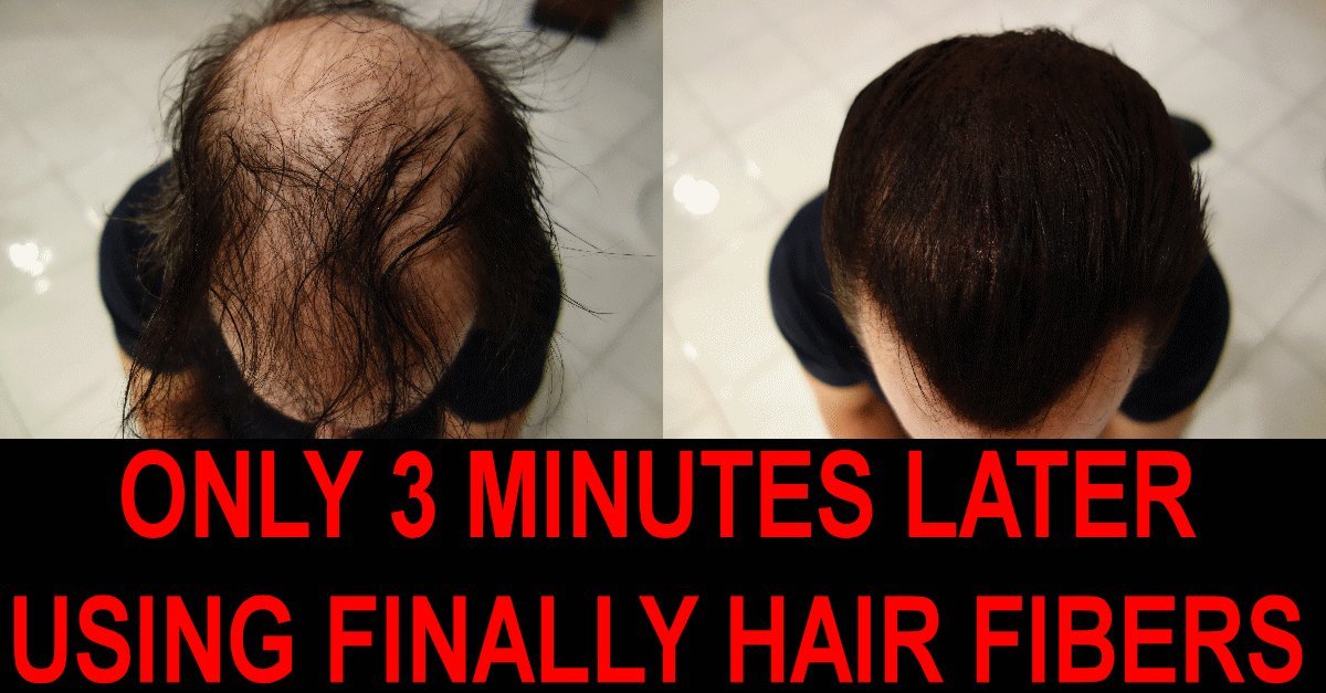 Hair Fiber Sprayer Atomizer with Anti-Clog Nozzle OVER 100,000 SOLD sprays all hair fiber brands like Finally Hair, Minute Hair, Toppik, Xfusion, Luxe, N'Hance, Boldify, Cuuva, Elevate, Infiiity, Dexe