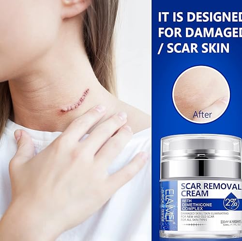 Miniatura 8 de Crema para eliminar cicatrices, gel avanzado para tratamiento de cicatrices quirúrgicas, cicatrices de acné, cesárea, quemaduras, estrías, para