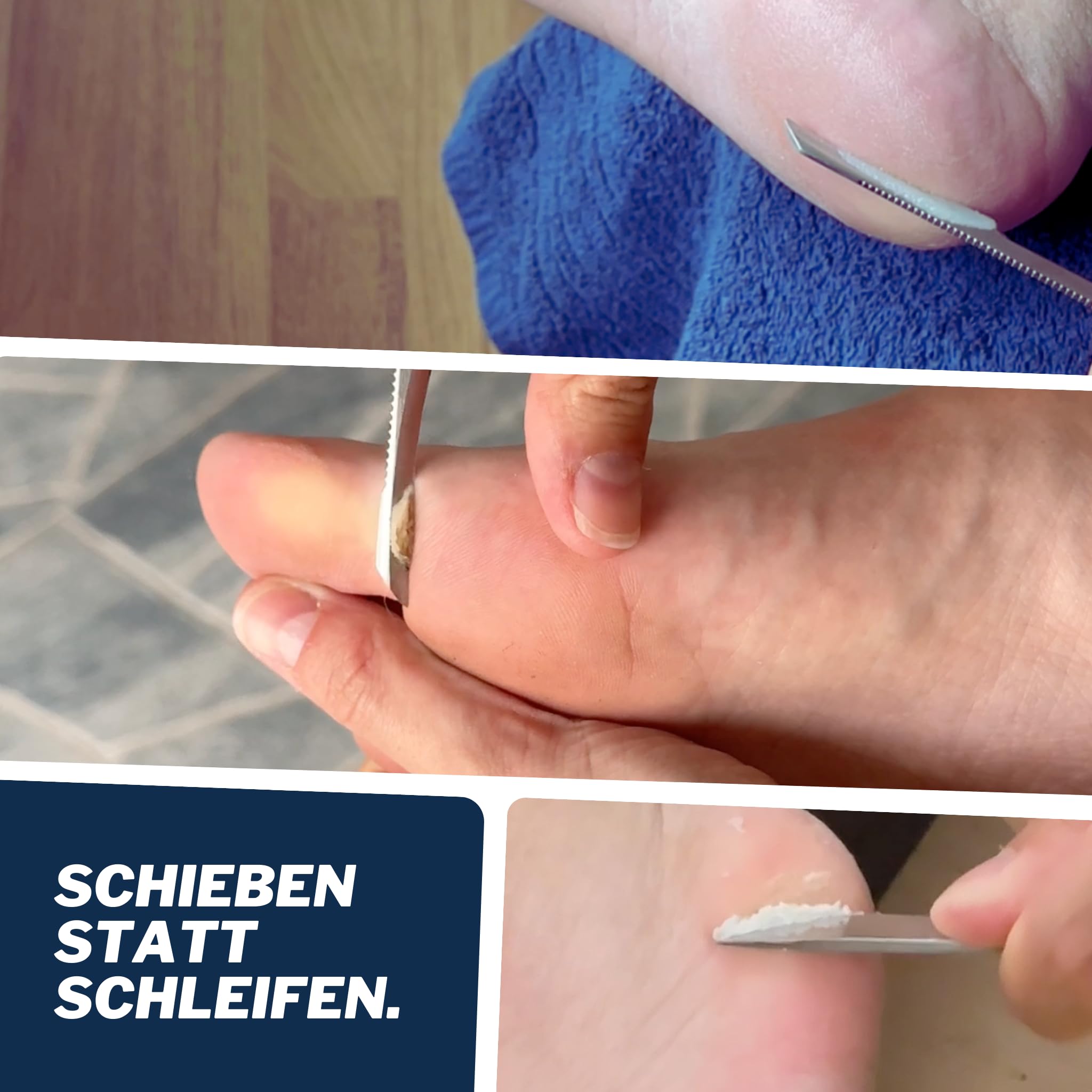 Mr. Fuss Starter Kit - 5 teilig, Hornhautentferner Systempaket