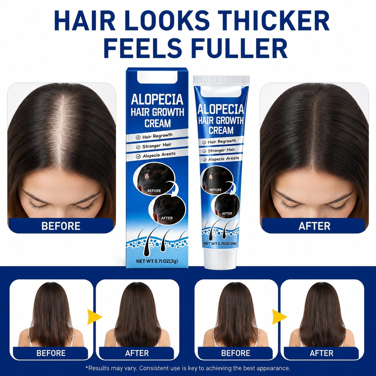 Alopecia Hair Growth Cream with Biotin & Rosemary Oil | Anti Hair Loss Treatment for Thicker Fuller Hair, Scalp Nourishing Butter for Thinning Hair, Intensive Hair Densifying Essence for Men & Women