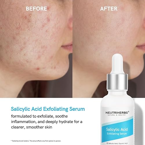 Miniatura 8 de NEUTRIHERBS Suero exfoliante de ácido salicílico, poros sin obstrucciones y minimizados, suero facial para piel grasa y propensa al acné - 1 onza