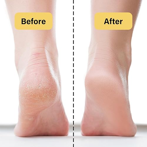 Miniatura 7 de Sarga grande de carne alimentada con pasto para la piel, sarga de res para la cara, humectante facial de ternera orgánica, sargo natural y bálsamo