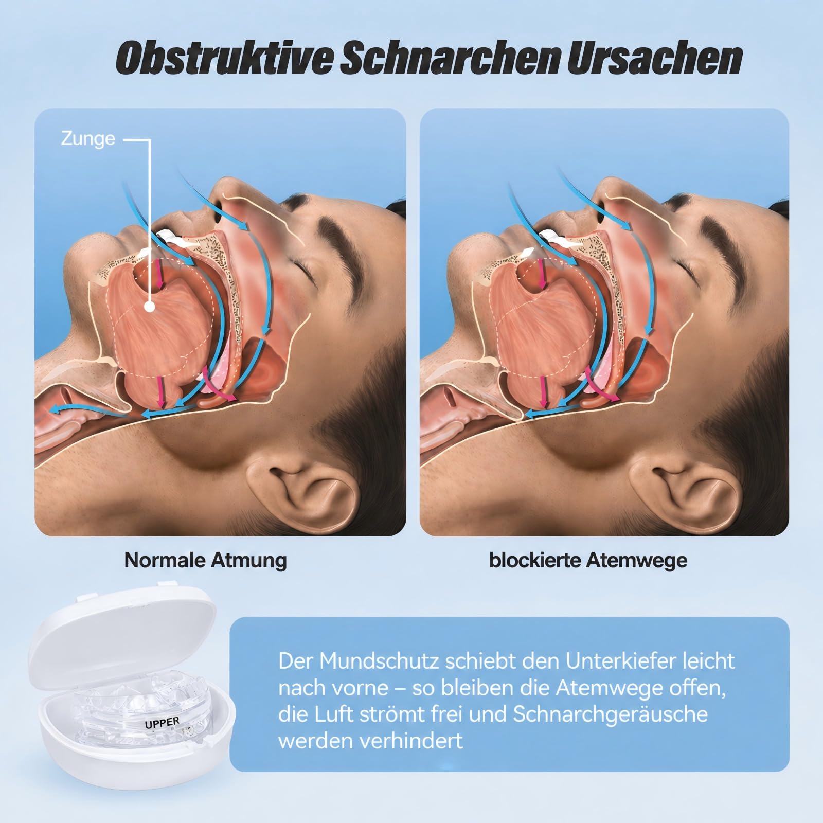 Schnarchstopper Anti Schnarch, Schnarchschiene Gegen Zähneknirschen und Schnarchen für MäNner Und Frauen(Weiß)