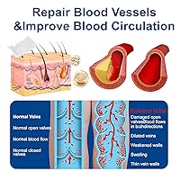 Vista 6 de Vein Target Microdarts Patch, tratamiento profesional de venas varicosas para piernas, parche GFOUK Vein Target, alivia la circulación sanguínea