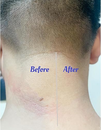 Miniatura 6 de CPAP - Almohadilla para el cuello para correas de protección CPAP compatible con máscara CPAP completa para reducir la presión del arnés y las